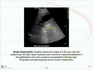 Imaging Acute Abdomen (Part 1)