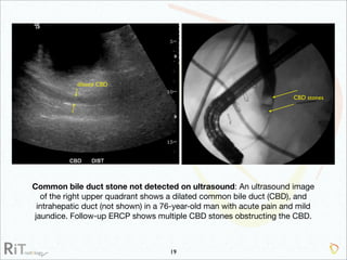 Imaging Acute Abdomen (Part 1)