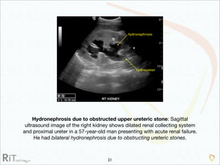 Imaging Acute Abdomen (Part 1)