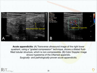 Imaging Acute Abdomen (Part 1)