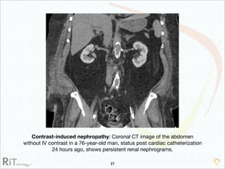 Imaging Acute Abdomen (Part 1)