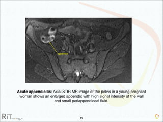 Imaging Acute Abdomen (Part 1)