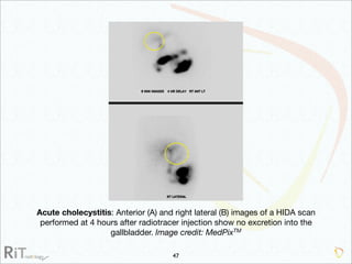 Imaging Acute Abdomen (Part 1)