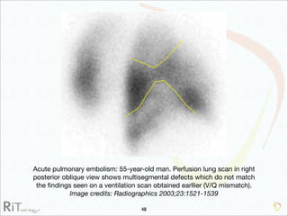 Imaging Acute Abdomen (Part 1)