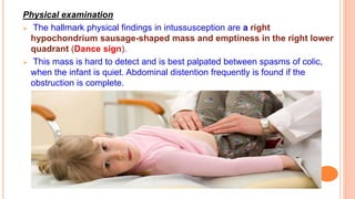 Physical examination
 The hallmark physical findings in intussusception are a right
hypochondrium sausage-shaped mass and emptiness in the right lower
quadrant (Dance sign).
 This mass is hard to detect and is best palpated between spasms of colic,
when the infant is quiet. Abdominal distention frequently is found if the
obstruction is complete.
 