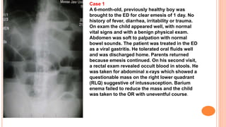 Case 1
A 6-month-old, previously healthy boy was
brought to the ED for clear emesis of 1 day. No
history of fever, diarrhea, irritability or trauma.
On exam the child appeared well, with normal
vital signs and with a benign physical exam.
Abdomen was soft to palpation with normal
bowel sounds. The patient was treated in the ED
as a viral gastritis. He tolerated oral fluids well
and was discharged home. Parents returned
because emesis continued. On his second visit,
a rectal exam revealed occult blood in stools. He
was taken for abdominal x-rays which showed a
questionable mass on the right lower quadrant
(RLQ) suggestive of intussusception. Barium
enema failed to reduce the mass and the child
was taken to the OR with uneventful course.
 