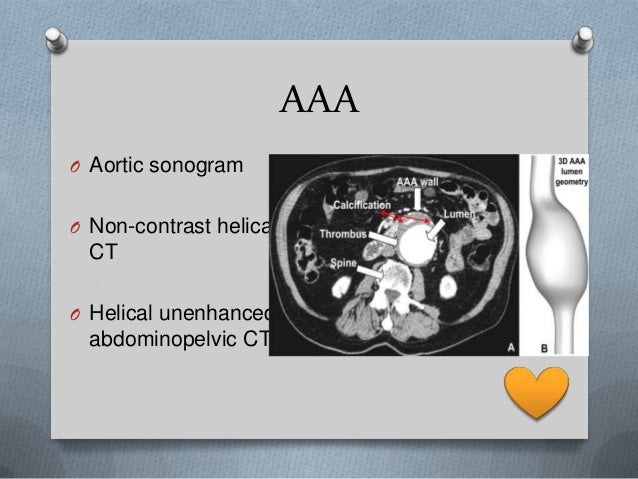 Acute Abdominal Pain