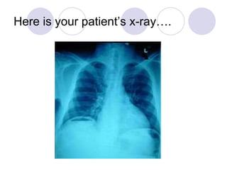 Here is your patient’s x-ray….
 