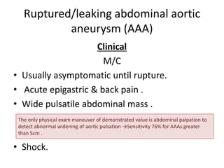 Acute abdominal pain | PPTX