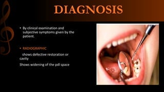 Acute alveolar abscess | PPTX