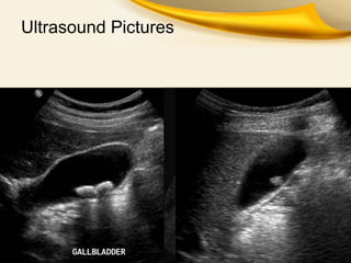 Ultrasound Pictures
 