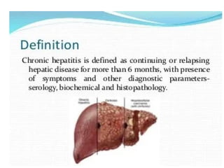 Acute and chronic hepatitis power point | PPTX
