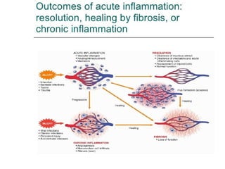 Inflammation Reflection Acute and chronic inflammation | PPT