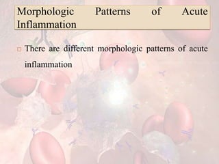Morphologic Patterns of Acute
Inflammation
 There are different morphologic patterns of acute
inflammation
 