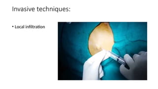 Local Infiltration Injection Acute and Chronic Pain Managsssement.pptx