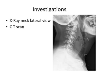 Investigations
• X-Ray neck lateral view
• C T scan
 