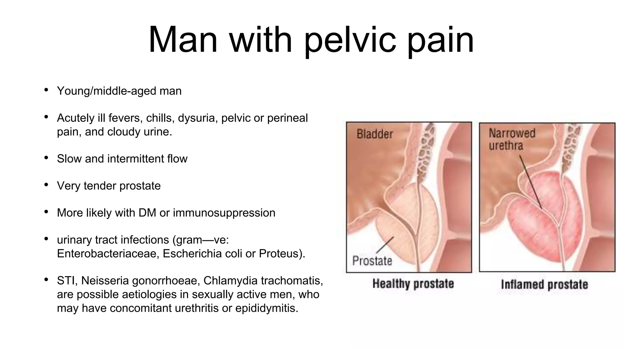 Acute and chronic prostatitis presentation IDF Malaga | PPTX
