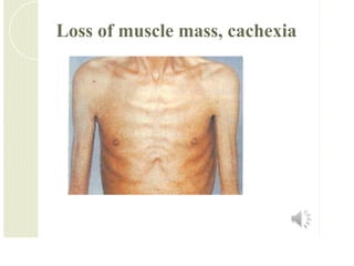 Acute and chronic renal failure hvhbhbubub | PDF