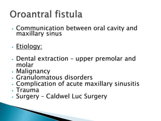 ⦁ Communication between oral cavity and
maxillary sinus
⦁ Etiology:
⦁ Dental extraction – upper premolar and
molar
⦁ Malignancy
⦁ Granulomatous disorders
⦁ Complication of acute maxillary sinusitis
⦁ Trauma
⦁ Surgery – Caldwel Luc Surgery
 