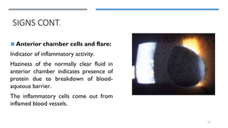 Acute anterior uveitis by Dr. Rubana.pptx