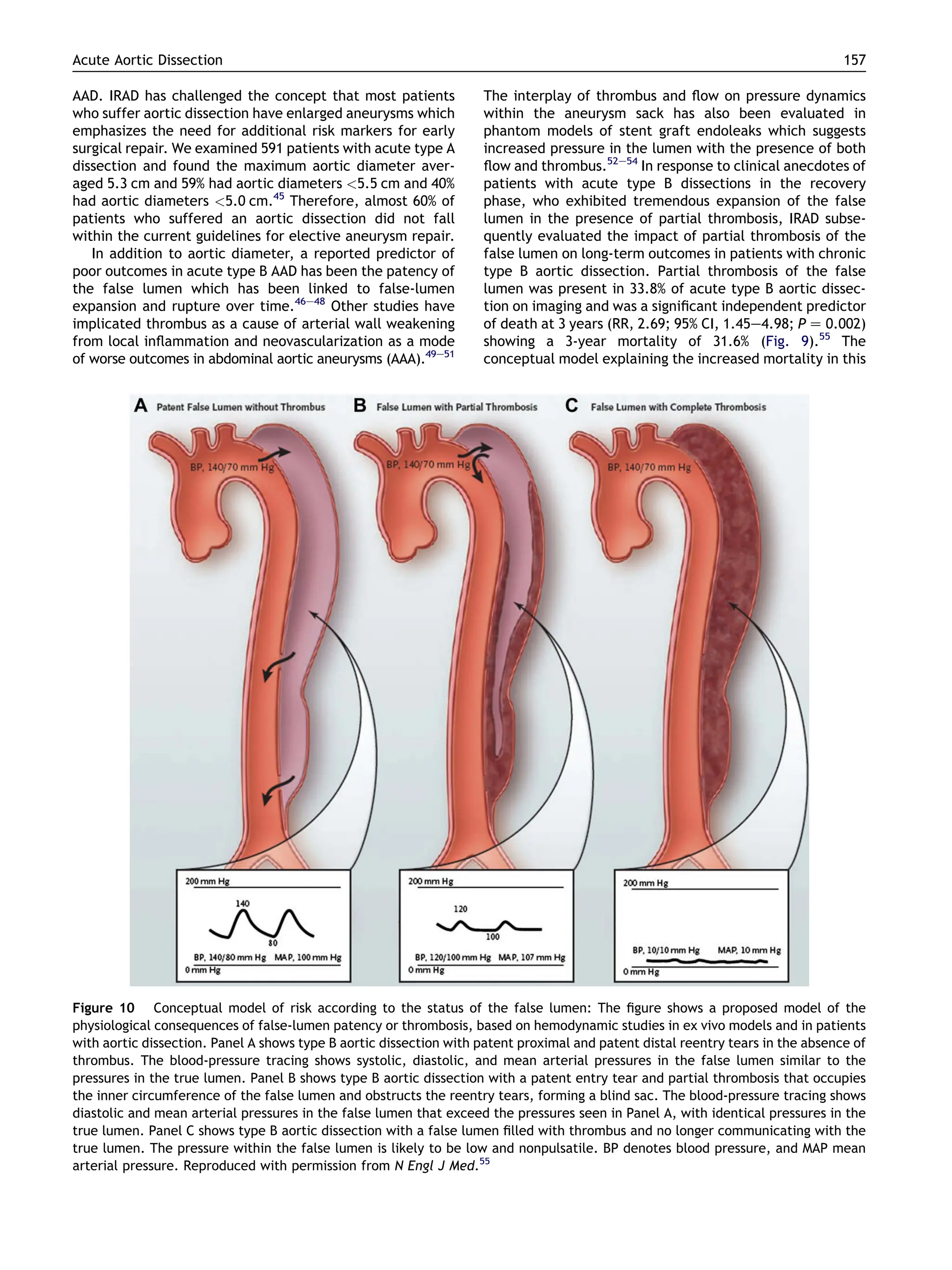 Acute Aortic Dissection- Perspectives from the International Registry ...