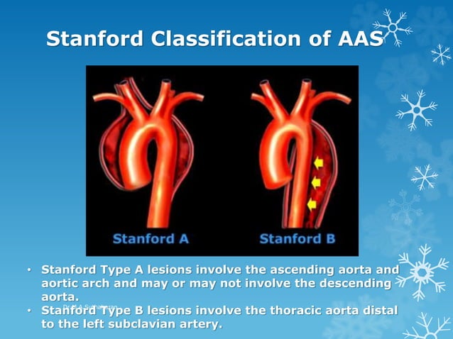 Acute Aortic Syndrome | PPTX