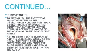 -!!! IMPORTANT !!!:
-TO DISTINGUISH THE ENTRY TEAR
FROM THE EXTENT OF THE
DISSECTION AS SURGERY FOR TYPE A
DISSECTION AIMS TO EXCISE THE
ENTRY TEAR BUT OFTEN LEAVES
RESIDUAL SEPARATED LAYERS OF
THE AORTIC ARCH AND DESCENDING
AORTA
-AS THE ENTRY TEAR IS ELIMINATED
AND THE LAYERS ARE JOINED AT THE
DISTAL ASCENDING AORTA, NO
FURTHER BLOOD CAN ENTER THE
FALSE LUMEN UNLESS ADDITIONAL
ENTRY INTIMAL TEARS EXIST WITHIN
THE AORTA
CONTINUED…
 