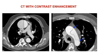 CT WITH CONTRAST ENHANCEMENT
 