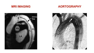 MRI IMAGING AORTOGRAPHY
 