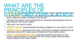 - ENTRY TEAR: RESECT AND REPLACE THE SITE OF THE AORTIC ENTRY TEAR
- AORTIC ROOT: TO PREVENT CORONARY MALPERFUSION AND LATE AORTIC
ROOT COMPLICATIONS, SURGERY CAN EITHER:
- - REPAIR THE AORTIC SINUS SEGMENTS BY ADHESIVE RECONSTRUCTION TO
OBLITERATE THE FALSE LUMEN;
- - REPLACE THE AORTIC ROOT
- AORTIC VALVE: RESUSPENSION OR REPLACEMENT OF THE AORTIC VALVE
- AORTIC ARCH: HEMI-ARCH OR TOTAL ARCH REPLACEMENT DEPENDING ON
WHETHER THE ENTRY TEAR HAS EXTENDED INTO THE AORTIC ARCH
- DISTAL ANASTOMOTIC LINE: ADHESIVE RECONSTRUCTION AT THE
DISTAL ANASTOMOSIS TO OBLITERATE THE FALSE LUMEN AND RESTORE
FLOW THROUGH THE TRUE LUMEN
WHAT ARE THE
PRINCIPLES OF
STANFORD TYPE A ATAD?
 