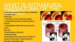 WHAT IS INTRAMURAL
HAEMATOMA OF THE
AORTA?BLOOD WITHIN AORTIC MEDIA WITHOUT PRESENCE
OF INTIMAL TEAR
AETIOLOGY:
1. RUPTURE OF VASA VASORUM OF MEDIA;
2. HAEMORRHAGE WITHIN ATHEROSCLEROTIC
PLAQUE;
3. PROGRESSION FROM PENETRATING AORTIC
ULCER
IMHs CAN:
- SPONTANEOUSLY RESOLVE;
- INCREASE IN SIZE
UNLIKE DISSECTIONS, IMHs OCCUR CLOSER TO
ADVENTITIA AND ARE AT GREATER RISK OF
RUPTURE THAN DISSECTIONS
 