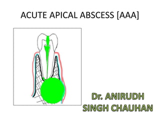 ACUTE APICAL ABSCESS [AAA]
 