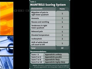Mantrell Score Acute apendisitis | PPTX