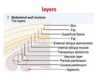 Acute appendicitis | PPTX