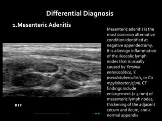 Differential Diagnosis
1.Mesenteric Adenitis
Mesenteric adenitis is the
most common alternative
condition identified at
negative appendectomy.
It is a benign inflammation
of the ileocolic lymph
nodes that is usually
caused by Yersinia
enterocolitica,Y.
pseudotuberculosis, or Ca
mpylobacter jejuni. CT
findings include
enlargement (> 5 mm) of
mesenteric lymph nodes,
thickening of the adjacent
cecum and ileum, and a
normal appendix
 