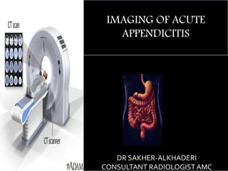 CT
DR SAKHER-ALKHADERI
CONSULTANT RADIOLOGIST AMC
IMAGING OF ACUTE
APPENDICITIS
 