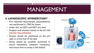 Acute Appendicitis | PDF