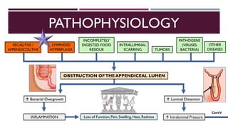 Acute Appendicitis | PDF