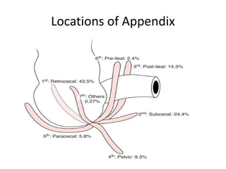 Acute appendicitis | PPTX