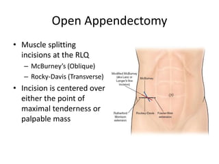 Acute appendicitis
