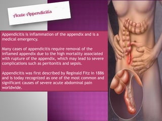Acute appendicitis | PPTX