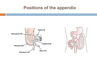 Appendix Position Variations Acute appendicitis | PPTX