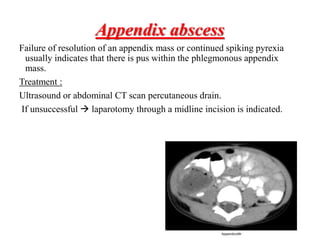 Acute Appendicitis-١.pptx