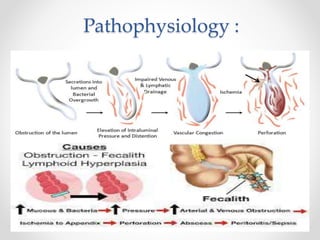 Acute Appendicitis.pptx