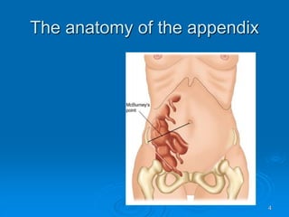 Acute Appendicitis.ppt