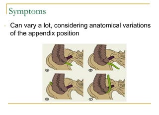 Appendix Position Variations Acute appendicitis.pdf