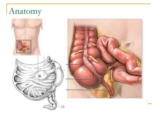 Acute appendicitis.pdf