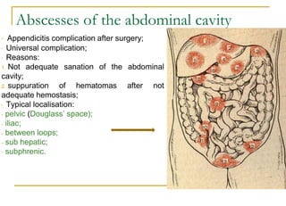 Acute appendicitis.pdf