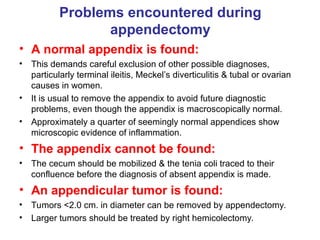 acute appendicitis.ppt acute appendicitis | PPT