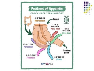 Apendix Target. Sign ACUTE APPENDICITIS | PPTX